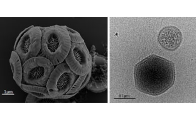 A cell, a virus and a vesicle. Left – An Emiliania huxleyi cell covered by calcium carbonate liths. Right – The large virus EhV and a vesicle produced during viral infection of Emiliania huxleyi. 