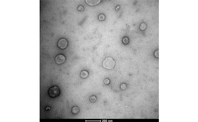 Vesicles shed via urine shown by electron-microscopy
